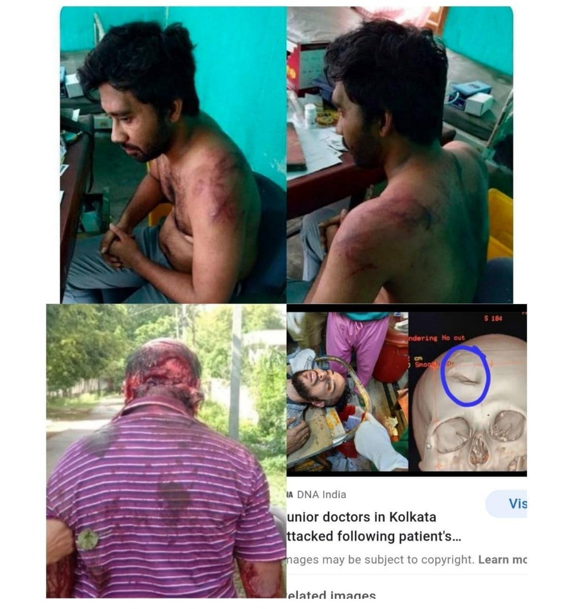 DrDrake_tweets's tweet photo. AMONG US are insane, inhumane people who should be rigorously punished for the sins of
staining their hands with the blood of a Doctor. #StopViolenceAgainstDoctors
#Medtwitter
#iStandWithDoctors
@PMOIndia @AmitShah @drharshvardhan @IMAIndiaOrg @ANI 
@Anshulspiritual https://t.co/7AH1kYzaL7