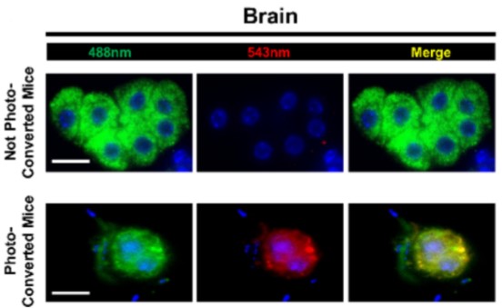 MetastasisRS's tweet photo. A brief report in @JCM_MDPI by MRS member @luciaborriell demonstrates using #photoconversion that #metastatic #cancer cells in the #lung can further disseminate to other distant sites. @EinsteinMed
https://t.co/yK5ARDOAIe https://t.co/V64P6yJshS