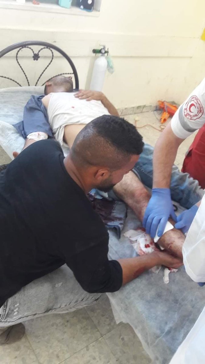 PalEvePlus's tweet photo. FollowUp | West Bank

15 Palestinians were wounded with live and metal bullets during the confrontations that erupted with Palestinians and Israeli occupation forces in the town of Beita in Nablus. #ApartheidIsrael #IsraeliCrimes #IsraeliTerrorists https://t.co/OGI2BhLWGV