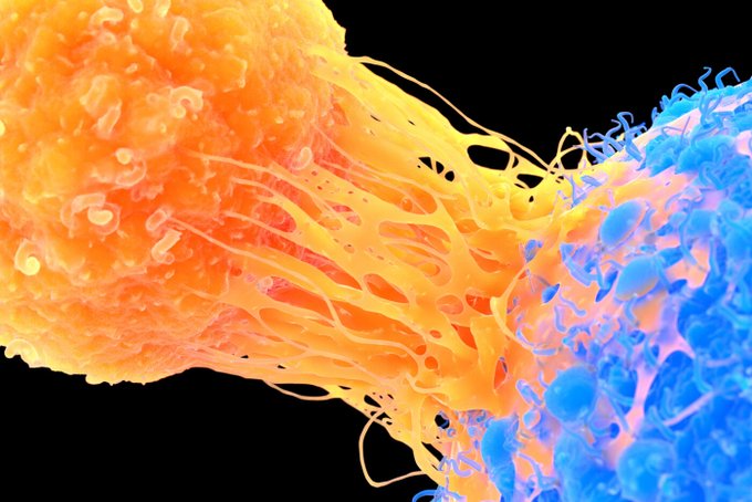 Applied50977115's tweet photo. #Researchers Uncover #Protein That Helps Tumors Evade #Immune System. Researchers identify a protein called secreted #gelsolin that aids tumors in evading the immune system...readmore@ https://t.co/V2HwwFfB9B https://t.co/6uFtQrebO8