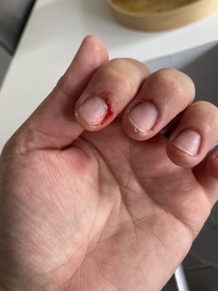 MissRReece's tweet photo. @IKEAUKSupport I received my order but three out of the four glasses I ordered were broken, one smashed badly (it even cut me) and there are shards of glass all over my items. I am really disappointed. https://t.co/7NM7eGm4M9