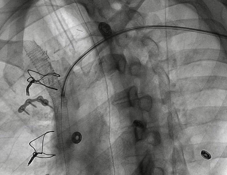 Ravi Srinivasa tweet media