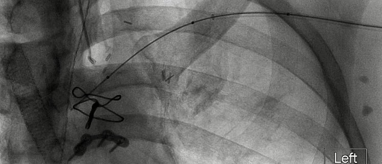 Ravi Srinivasa tweet media