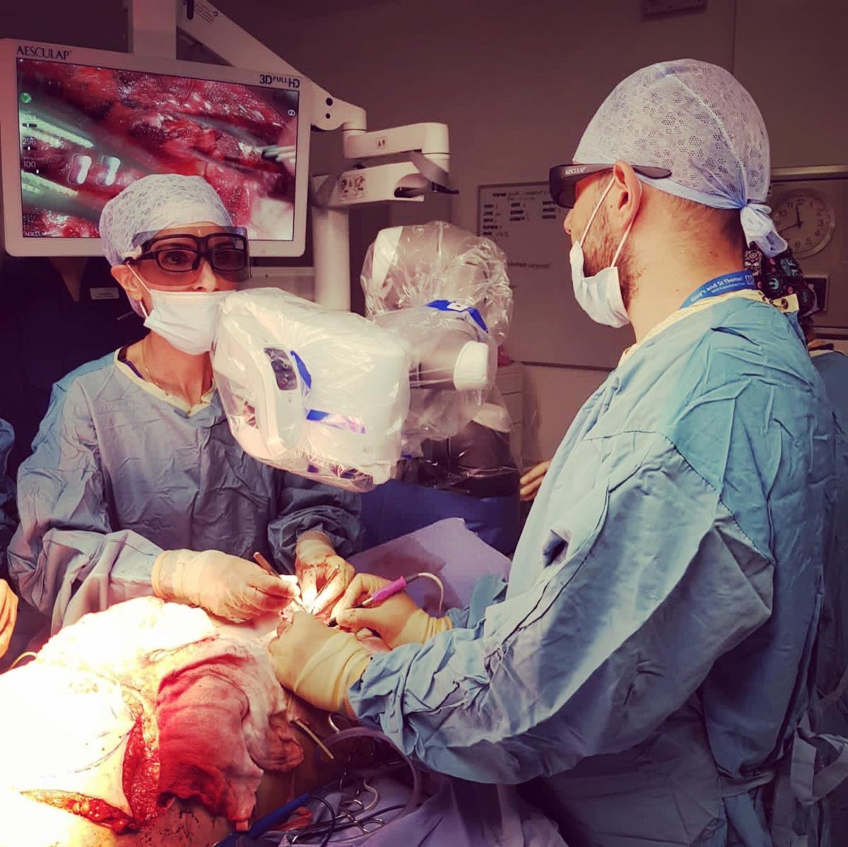 gsttplastics's tweet photo. GSTT plastic surgeons perform breast reconstruction surgery using 3D microscope - the first team in the UK to utilise this technology in reconstructive surgery #breastreconstruction #headsupsurgery #microsurgery #surgicalergonomics #firstinUK https://t.co/BRXSVjwUoM