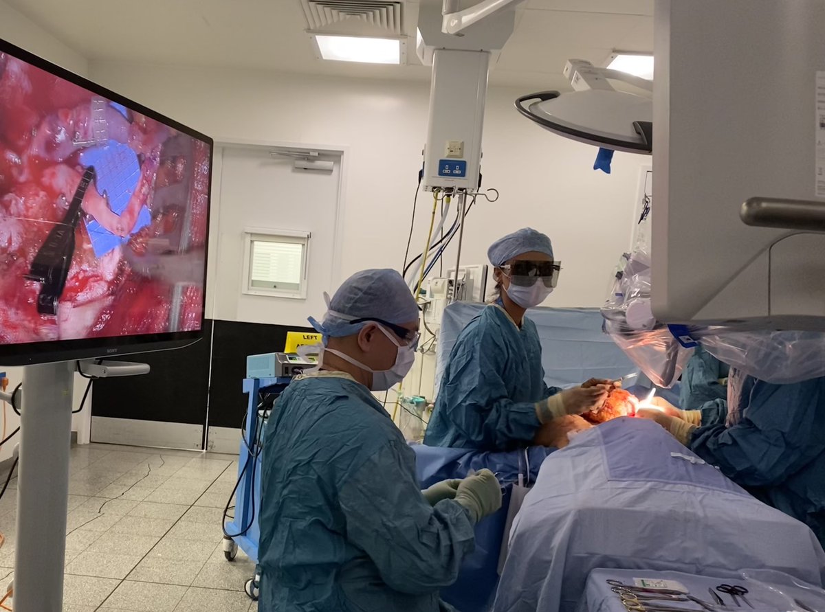 GSTT plastic surgeons perform breast reconstruction surgery using 3D microscope - the first team in the UK to utilise this technology in reconstructive surgery #breastreconstruction #headsupsurgery #microsurgery #surgicalergonomics #firstinUK