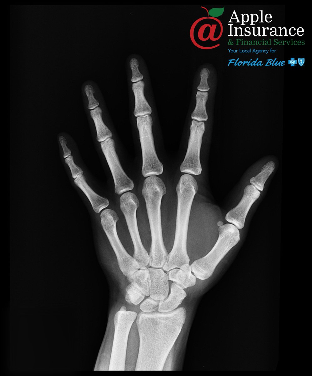 AppleInsurance3's tweet photo. Be prepared for sticks and stones!

Call for your free quote on Accident Insurance: 561.614.2400 https://t.co/WvasBrLziN