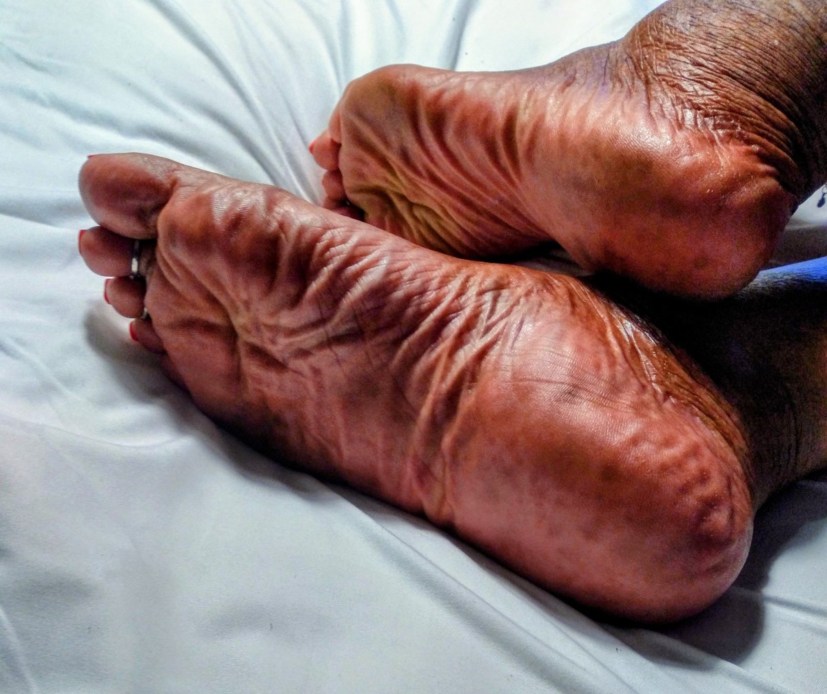 JCutetoes's tweet photo. Good Afternoon And Welcome To The Weekend Cuties ππ
#THEFEET #GALORELAND #wrinkledsoles #softsoles #widesoles # thicksoles #meatysoles #maturesoles #drainingsoles #meatpleasers https://t.co/nRMlWYd0nB