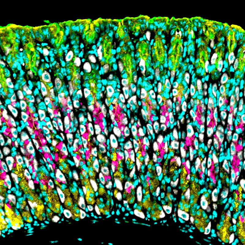 Getting back to my first scientific roots for #FluorescenceFriday, 🐭 stomach glands stained for parietal cells in white, mucous neck cells in pink, surface mucous pit cells in green, myosin 5b in yellow and nuclei in blue #SciArt #microscopy #bioart #science