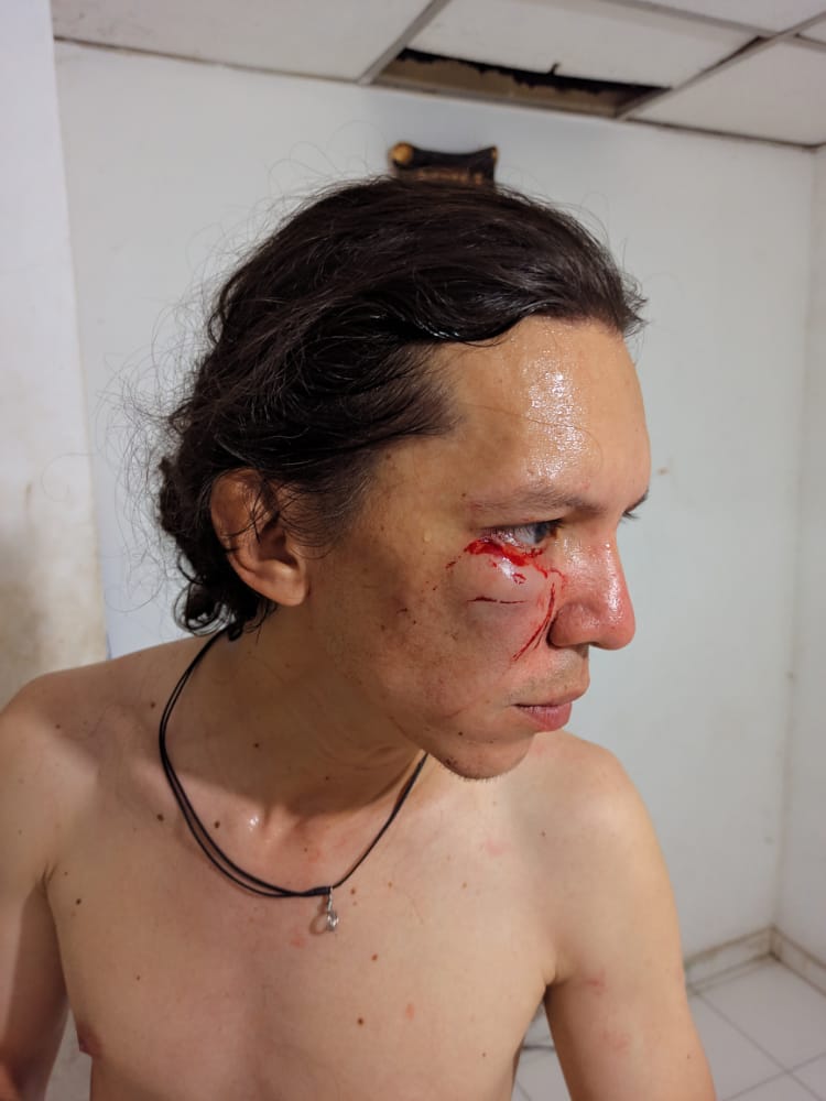 rueda_suelta's tweet image. #Atención En protestas en #Valledupar Periodista Jhonatan Giraldo @Jonnath34266631  colaborador de @rueda_suelta  fue agredido brutalmente por el #ESMAD y le quitaron su celular donde habia grabado los excesos de esta fuerza.

Favort difundir RT

#SOSColombiaDDHH 

@FLIP_org