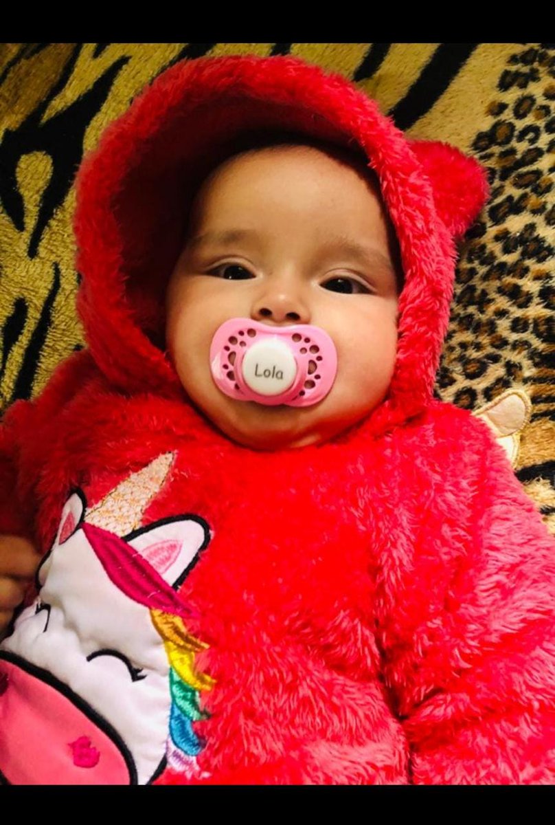 paulmardel's tweet photo. Ella es Lola Feranadez Sosa, tiene 5 meses tiene Esclerosis Tuberosa 1,Paarkinson white 4 Espasmos infantiles 4Hiper calcemia 3 y debe ser atendida en el Garraham x la Doctora Carilona Lorenzo, y mandan mail y le niegan el turno, x favor les pido denme RT desde ya MIL GRACIAS https://t.co/WONTr5XlBp