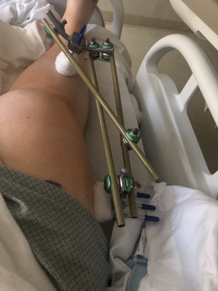 Hallerk97's tweet photo. Getting an MRI for my leg and the lady goes “what’s the reason for your visit?”... they need to see the tendons and muscles the doctor has to repair. “Okay but why?” https://t.co/eFtkMTijcp
