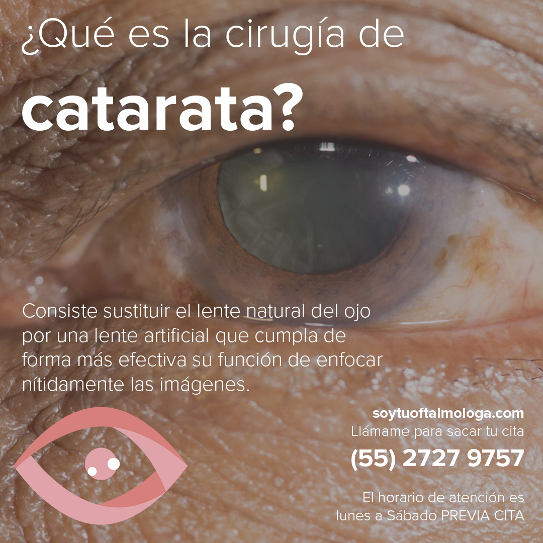 DRA. VIRIDIANA SANTIBAÑEZ GAONA 📅 Reserva tu cita: soytuoftalmologa.com/ubicacion/ 📞 Citas: (55) 2727 9757 #SoytuOftalmologa #OftalmologaViridiana #Oftalmo #Oftalmologa #Glaucoma #CirugiadeCatarata #LenteIntraocular #TratamientosOftalmologicos #SoyOftalmologoCertificado