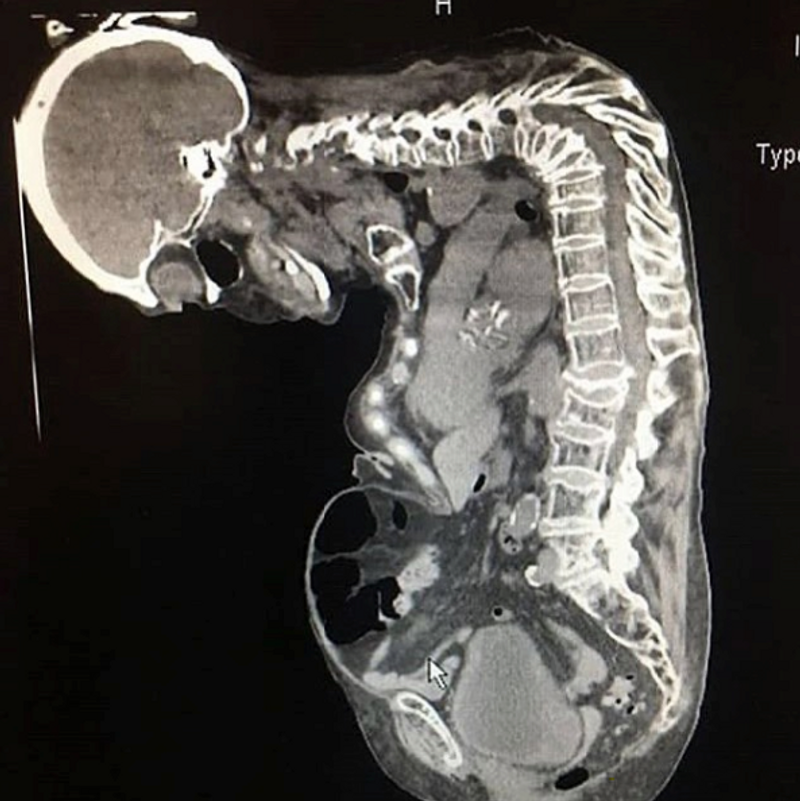 chubbyemu's tweet photo. chief complaint: worsening back pain https://t.co/acy6eFkuXf