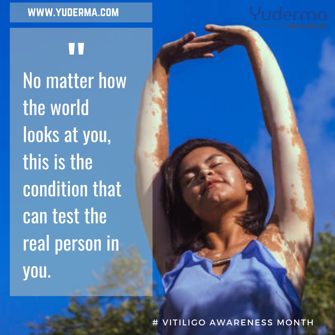 yudermaskincare's tweet photo. #vitiligo 
#vitiligoawareness 
#vitiligotreatment 
#VitiligoWorld 
#vitiligobeauty 
#VitiligoIndia https://t.co/zOigEp0Mn8