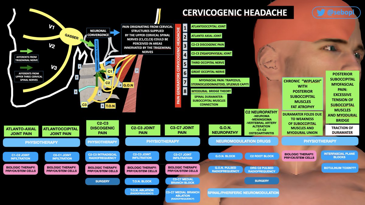 Cervicogenic Headache: pain originated from cervical structures 

🔴Pain Generators:

1️⃣ AtlantoOccipital Joint pain
2️⃣ Atlanto Axial Joint pain
3️⃣ C2-C3 Discogenic pain
4️⃣ C2-C3 &amp; C3-C7 Zygapophyseal Joint
5️⃣ T.O.N pain
6️⃣ G.O.N pain
7️⃣ Myofascial Pain
8️⃣ Myodural Bridge Pain