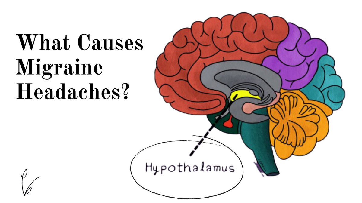 Googling the question, “What causes migraine headaches?” provides a list of possible triggers: 👉bright lights 👉the sun’s glare 👉loud noises 👉strong odors Read more here: plantbased.com/what-causes-mi…