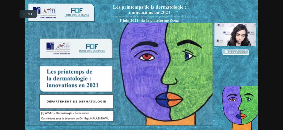 Fier de <a href="/JoyAssafMD/">Joy Assaf</a>! Deux belles presentations de cas pour les printemps de dermatologie <a href="/USJLiban/">USJ</a>!
