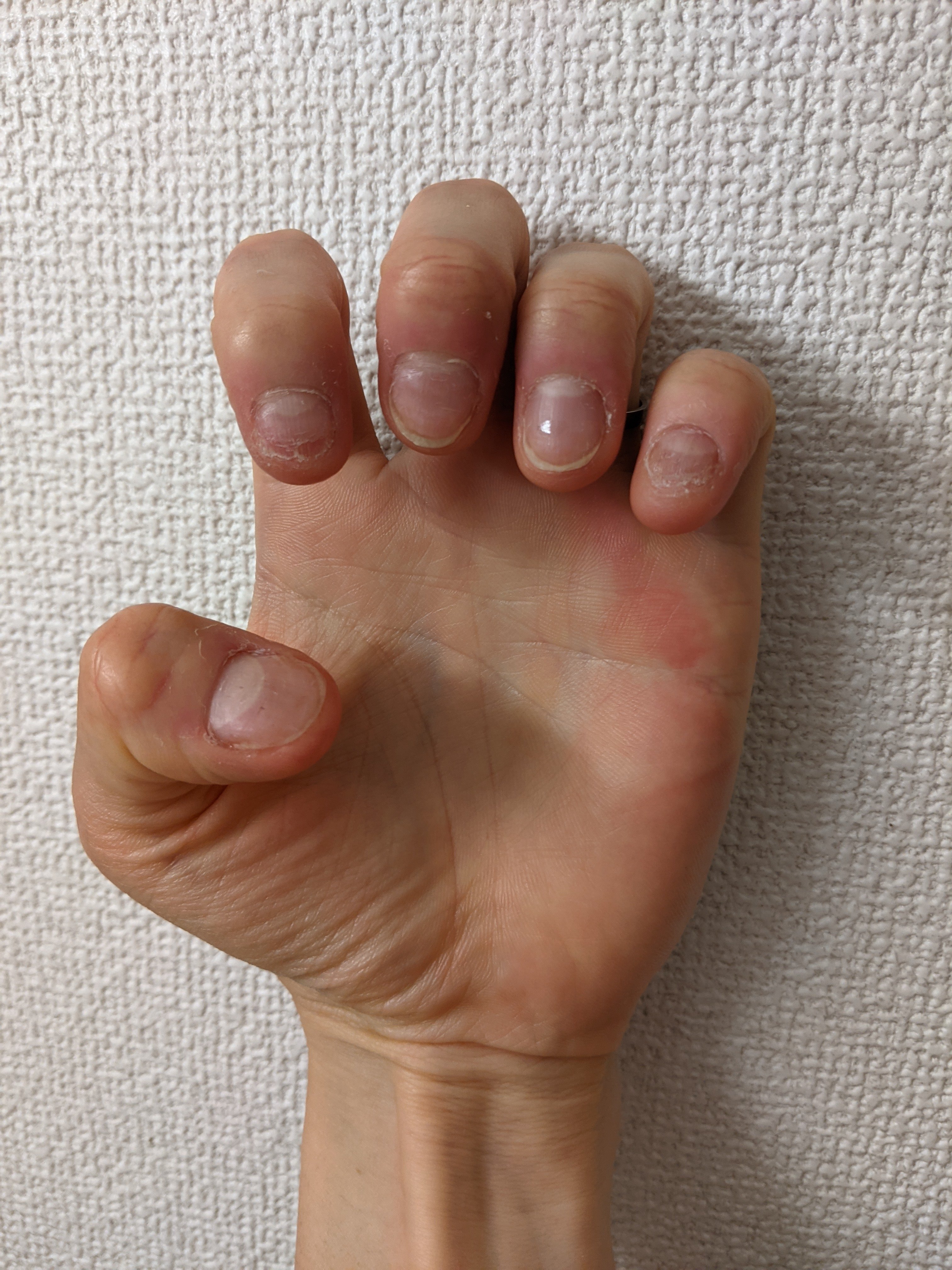 Stopnailbiting Twitter Search Twitter