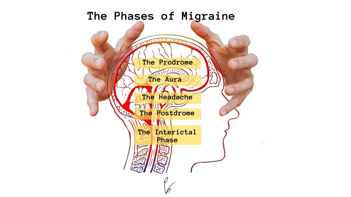 Extensive research has identified how the nervous system changes through each of a migraine headache’s five phases: Phase One: The Prodrome Phase Two: The Aura Phase Three: The Headache Phase Four: The Postdrome Phase Five: The Interictal Phase 👇 plantbased.com/what-causes-mi…