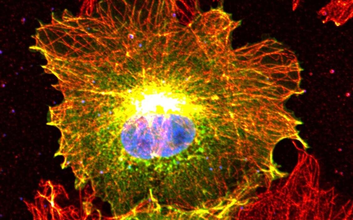 zozi_ingram's tweet photo. @MDC_Berlin @LNDWBerlin Super cool pictures! Thank you for the interesting explanation of what these beautiful pieces of science and art are! https://t.co/aeGYBi3xuI