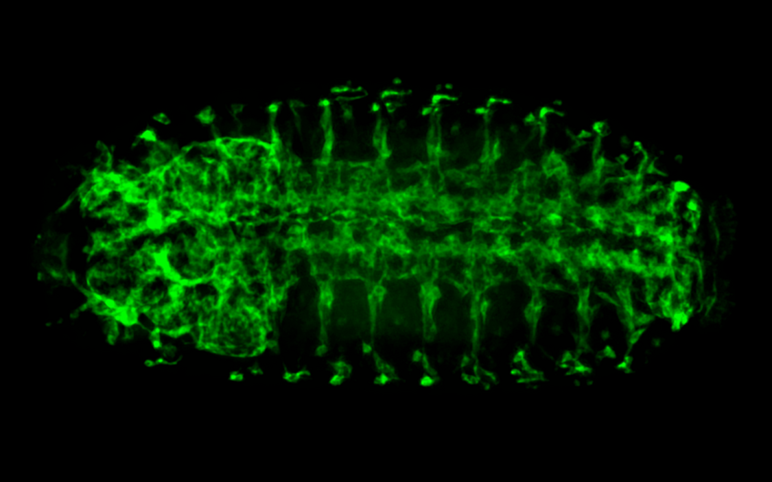zozi_ingram's tweet photo. @MDC_Berlin @LNDWBerlin Super cool pictures! Thank you for the interesting explanation of what these beautiful pieces of science and art are! https://t.co/aeGYBi3xuI