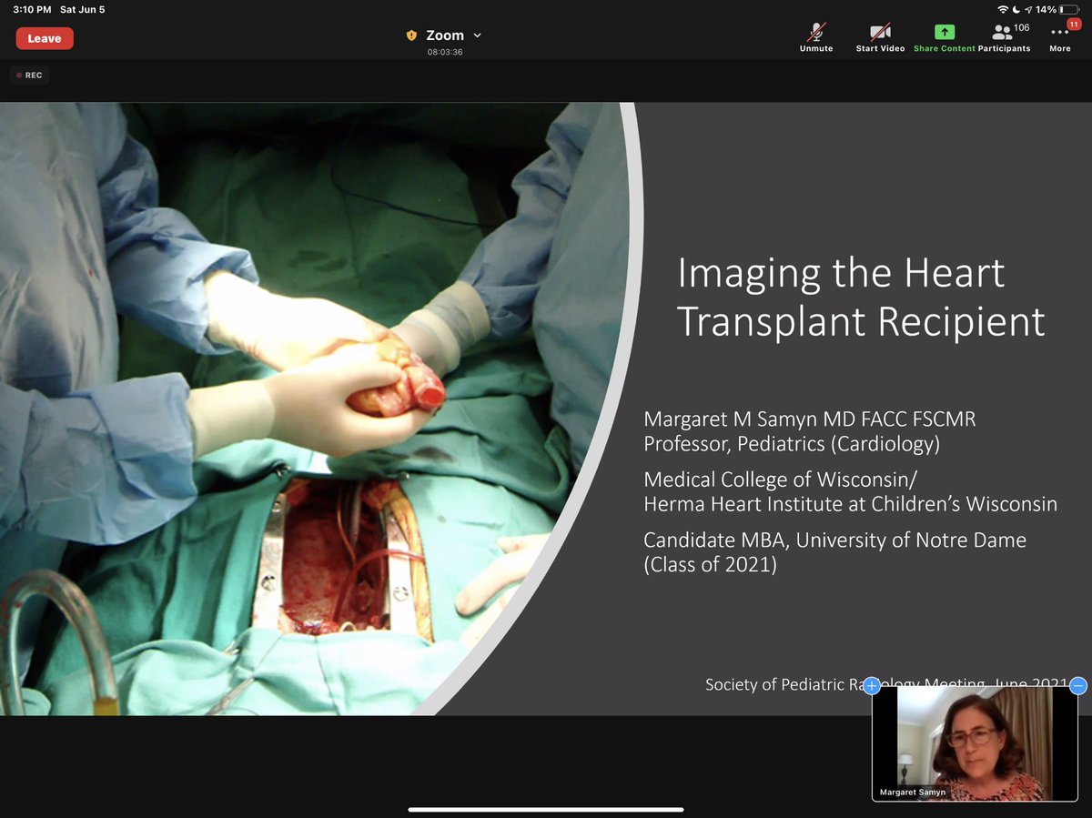 JennAcevedo's tweet photo. #CMR in Pediatric Heart Transplant #SPRCardiac21 #advancedsymposium #mri #imagingeducation https://t.co/FEmpOYuiy1