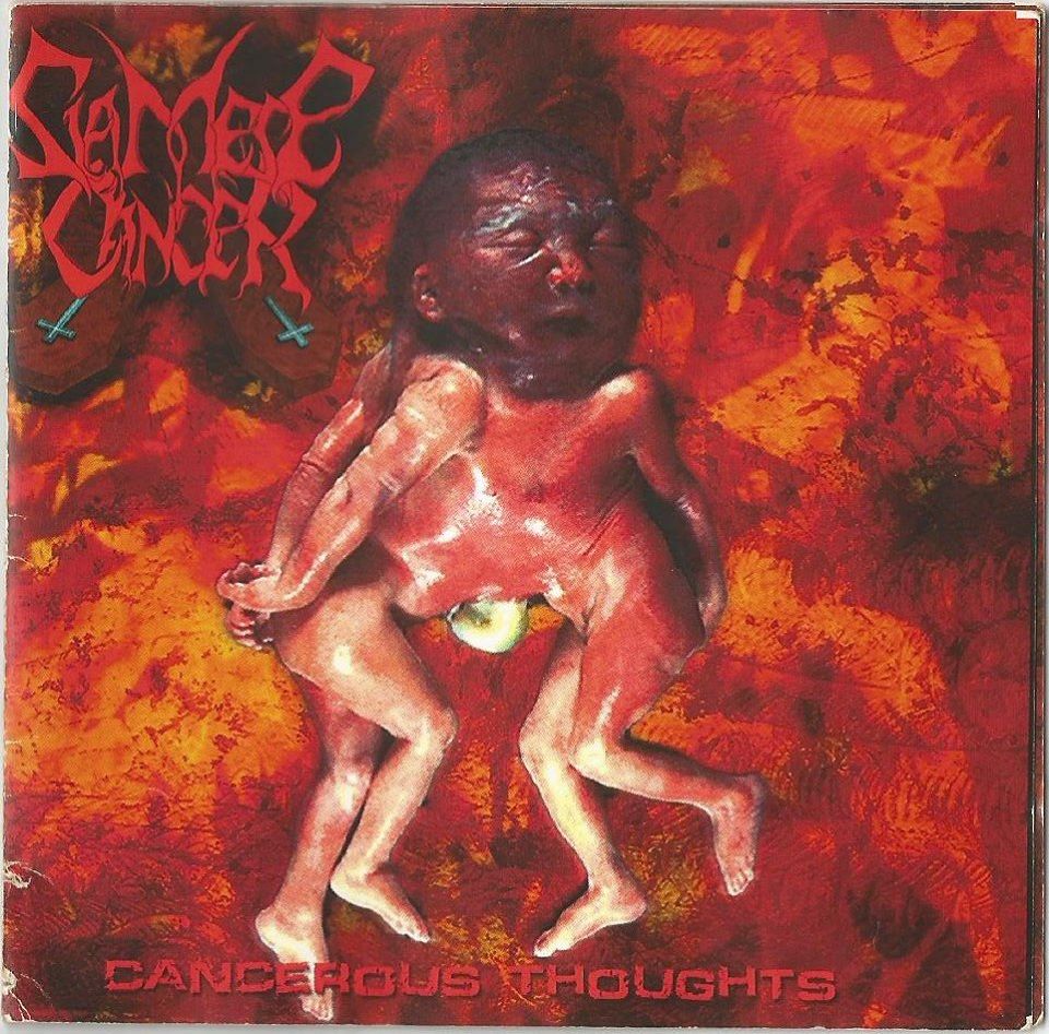 Band: Siamese Cancer
Genre: Death Metal 
Country of origin: Portugal
Location :Madeira Island 
Siamese Cancer (2003-2007)

Siamese Cancer was formed in the end of the November 2002.