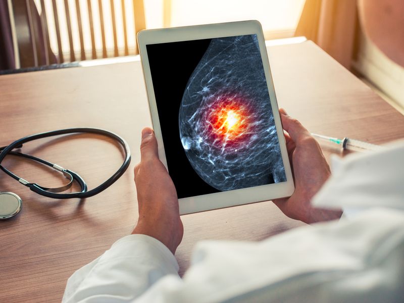 Myriad Genetics Recalibrates Breast Cancer PRS for All Ancestries in Anticipation of Broader Launch ow.ly/1Hec102LxbE