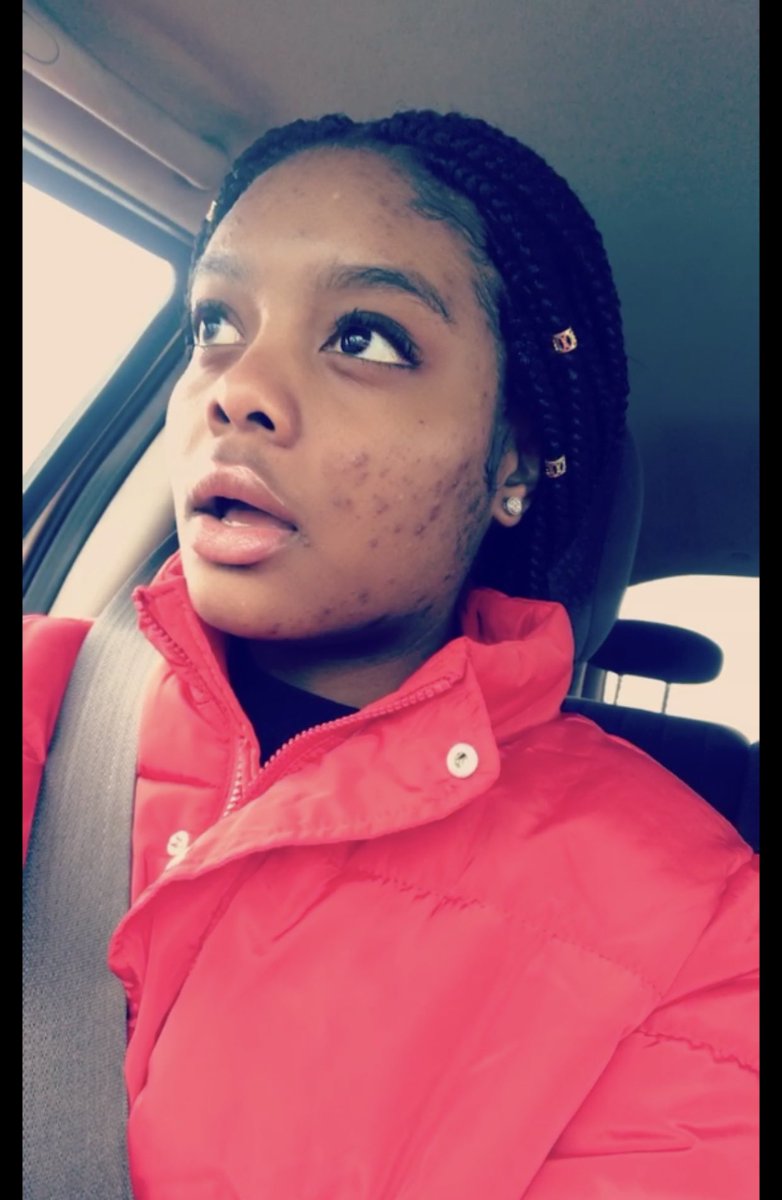 ArionWheeler's tweet photo. It’s also #acneawarenessmonth ,hits home every time. I suffer from severe acne and looking back i did everything man could think of. My skin isn’t perfect but I’ve worked extremely hard over the years to get to this level of confidence and i still struggle. #acneisnormal 🧡 #acne https://t.co/4Tnj6wQwah