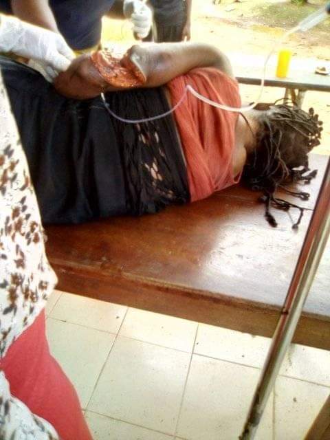 WMelchizedek's tweet photo. @Helper37216548 Here are some gruesome pictures of the ongoing massacre of the Biafrans/Igbos in Nigeria. https://t.co/kqI1rv8CI3