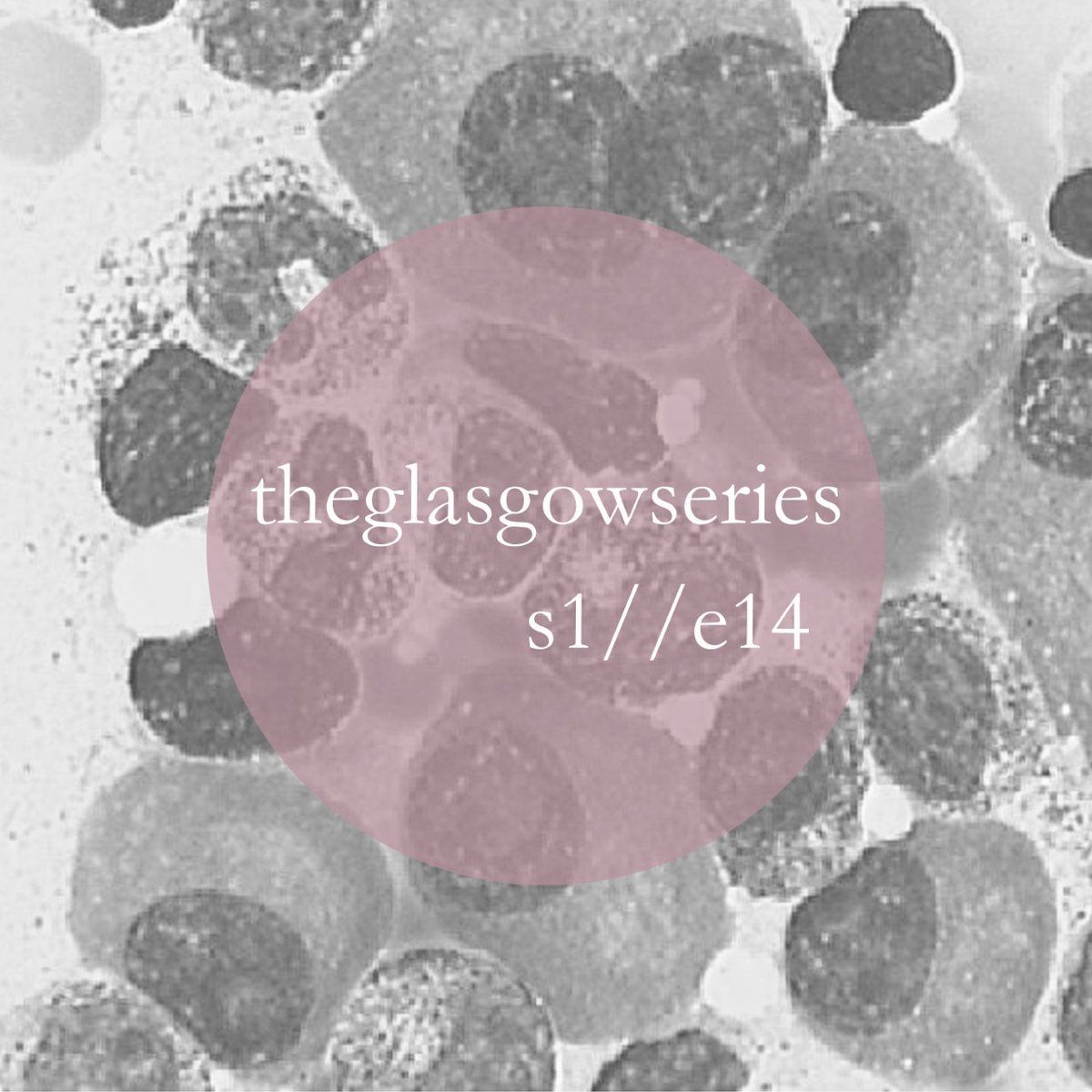 Take a listen to Dr Jacqueline Adams, Consultant Cardiologist on the podcast today! She joins us to discuss a case of coronary artery spasm in clinic, which leads to VT... theglasgowseries.co.uk and Spotify #theglasowseries #medicaleducationpodcast #Cardiology