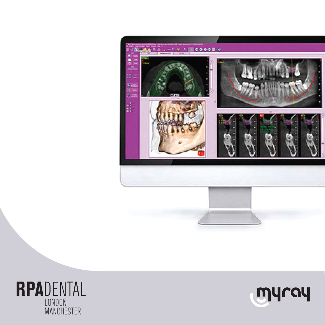HyperionX9 pro 

Advanced, reliable, iRYS.

The best all-in-one software platform for 2D and 3D

Multi-desktop 2D/3D - Implant simulation - Compatibility with third parties’ software - Sharing with 2D and 3D image viewer - iRYS Viewer for iPad
. #dentistry