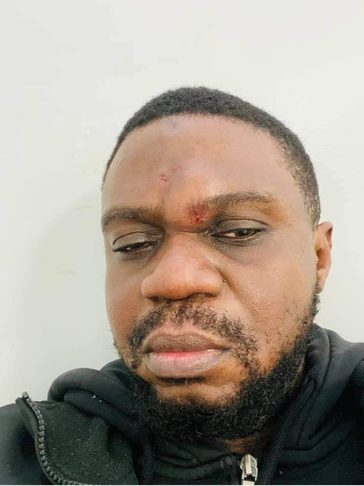 LamikaJoel's tweet photo. C'est avec la toute dernière énergie que je dénonce cette violence que vient de subir mon grand frère #Aime #Nkanu, victime d’une agression physique de la part d’un #algérien en #France. Nos frères #arabophones doivent arrêter avec ce complexe et cette violence vis à vis d noirs. https://t.co/6abanMkZsn
