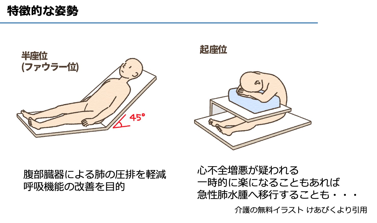 かさけん 心リハ専門の理学療法士 特徴的な姿勢 ファーラー位 臓器圧迫を解除し肺の容量を確保し楽と感じる姿勢 起座位 臥位になると咳嗽や呼吸苦のため寝れない 心不全 ので座位でどこかにもたれかかって休む姿勢 呼吸苦がファーラー位で軽減して かさけん 心リハ専門の理学療法士 特徴的な姿勢 ファーラー位 臓器圧迫を解除し肺の容量を確保し楽と感じる姿勢 起座位 臥位になると咳嗽や呼吸苦のため寝れない 心不全 ので座位でどこかにもたれかかって休む姿勢 呼吸苦がファーラー位で軽減して