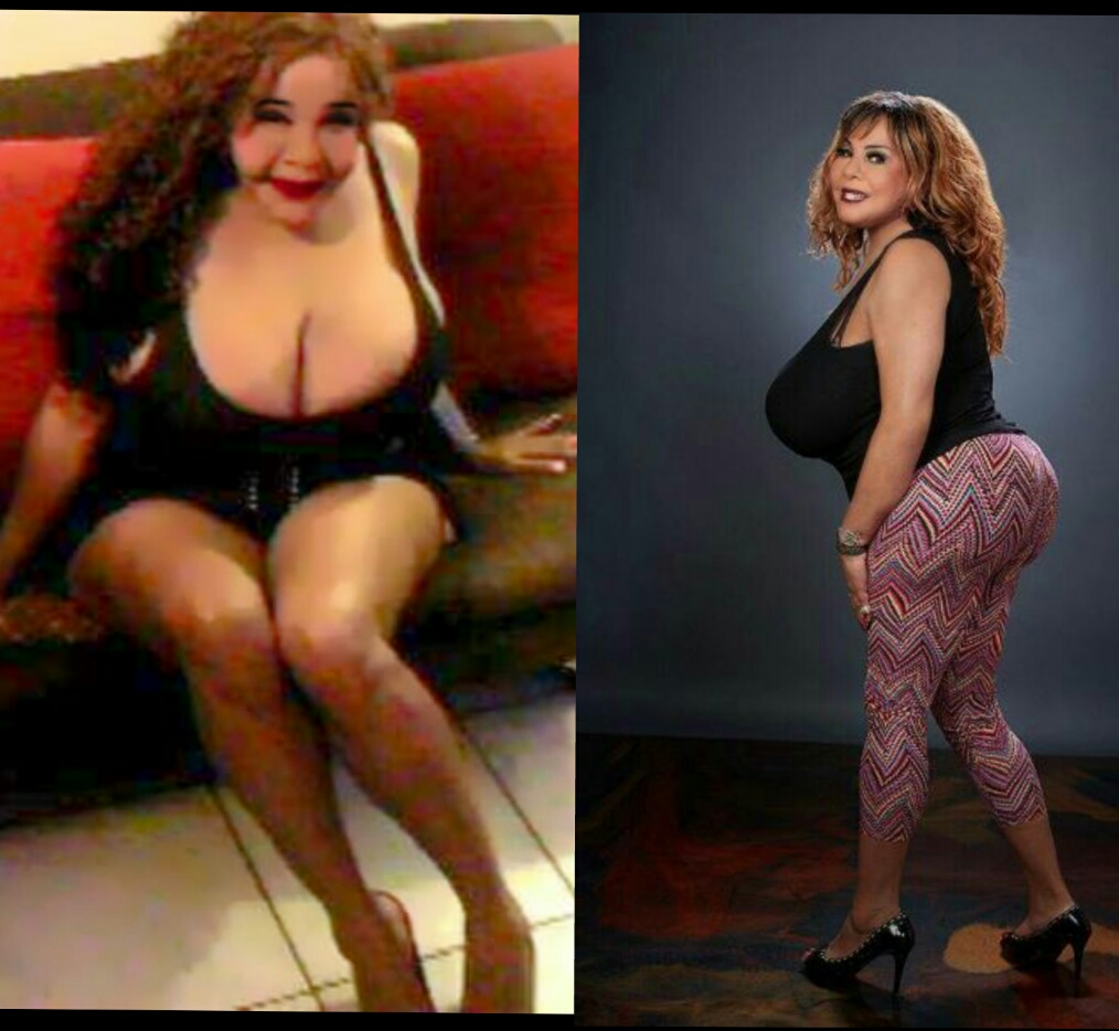 Rajee Rajindra Narin on X: CAST YOUR VOTE! Vote #1 for me to have a breast  reduction. Vote #2 for me to have a booty reduction. Vote #3 for me to have