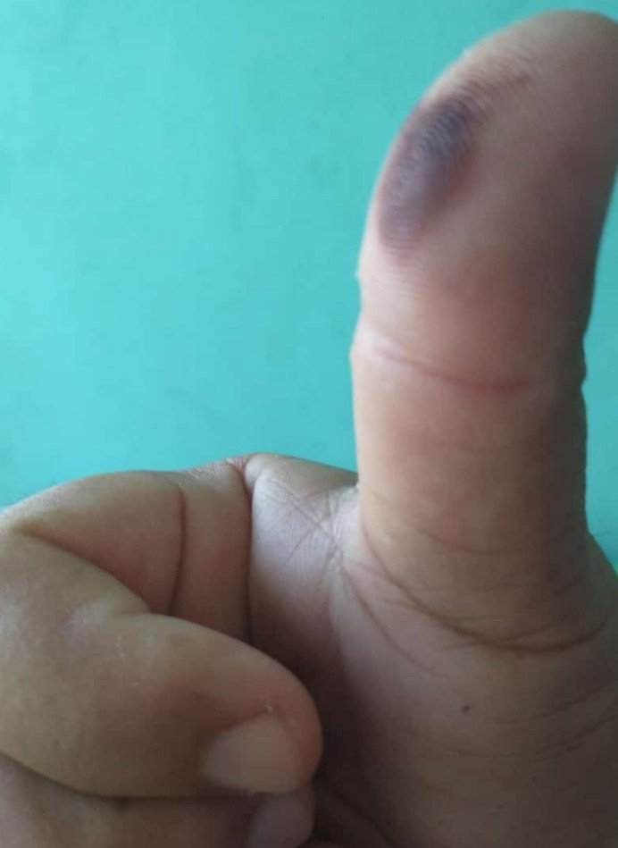 Listo ya mandamos a rechingar a su RPTM a los mugrosos de mugreña..