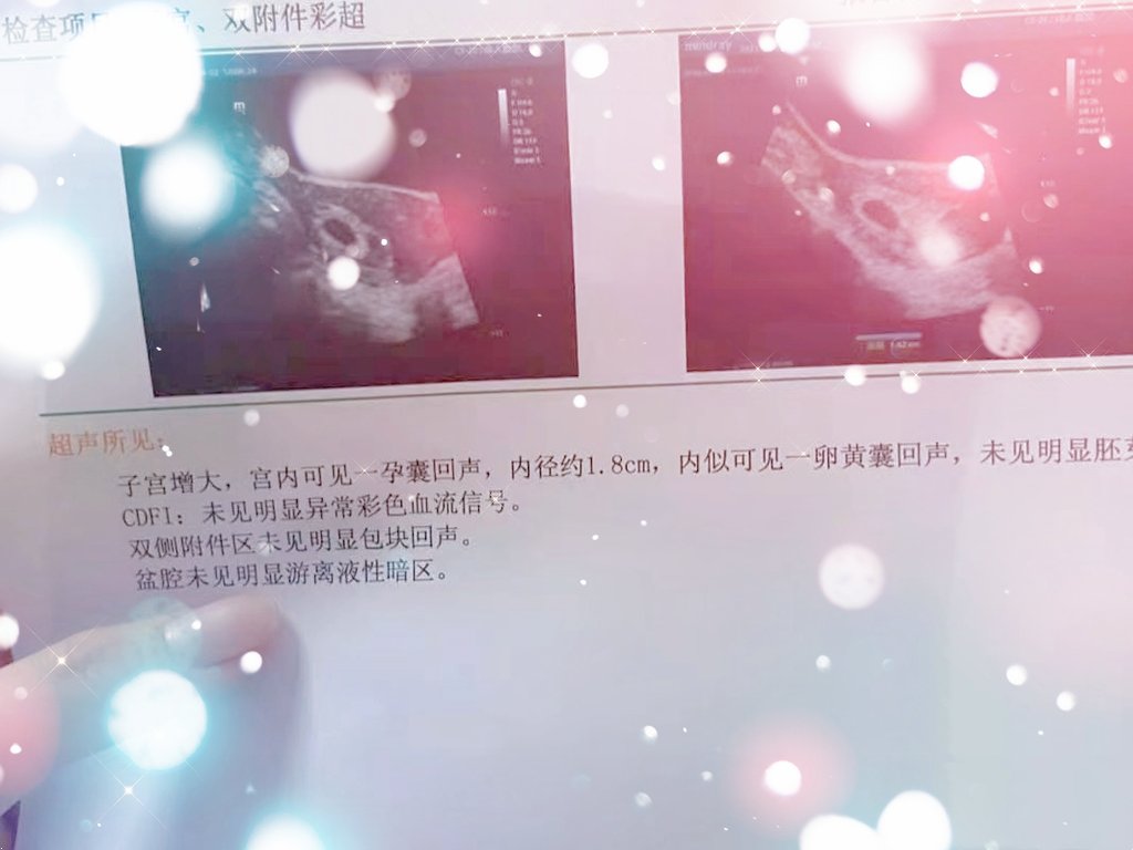 好久不在这里说话了，今天因为家有喜事啦才头脑一热上来写几句的，主人的意思是这些事还是少写啦，不定哪句话泄露点儿隐私就不得了，好吧，家有喜事，跪谢主人，闭嘴了先😂。 https://t.co/qAn1dVA6bT