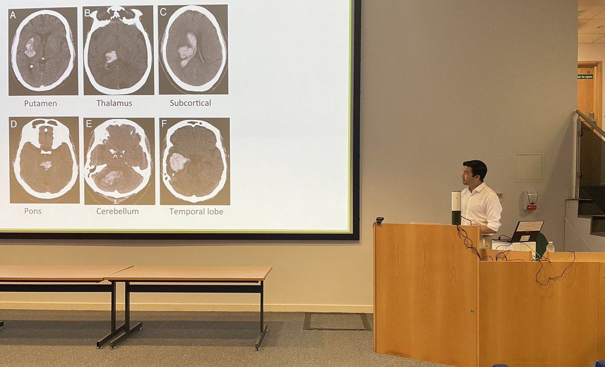 Hani Marcus (@hani_marcus) on Twitter photo Warm welcome to those joining us at the <a href="/QSReview/">Queen Square Neurosurgery Review Course</a> course today, and huge thanks again to our session leads, all those that have done all the hard work setting up! #Neurosurgery #QSNS21 Warm welcome to those joining us at the <a href="/QSReview/">Queen Square Neurosurgery Review Course</a> course today, and huge thanks again to our session leads, all those that have done all the hard work setting up! #Neurosurgery #QSNS21
