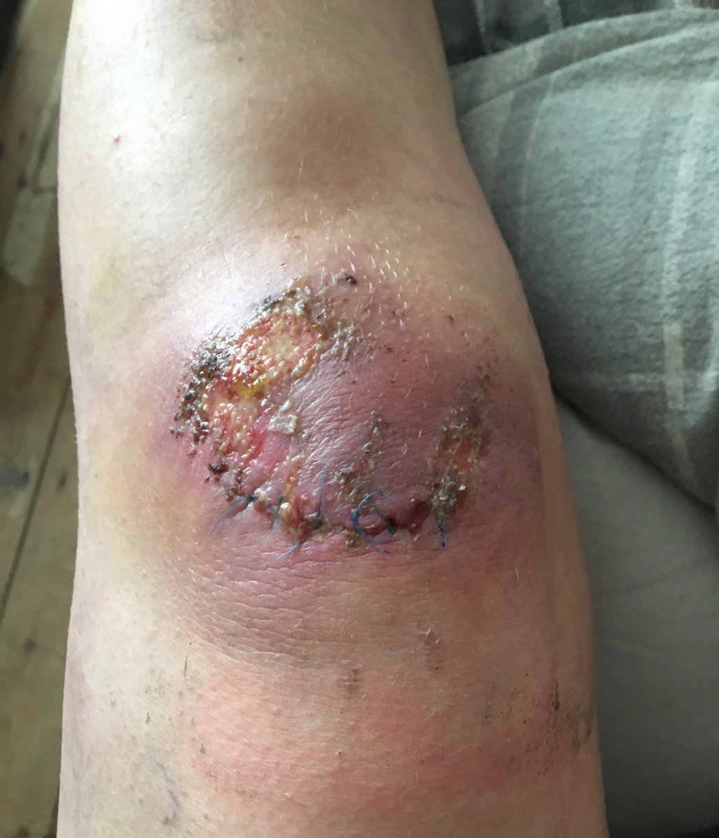 Stefs animal rescue 🌱🐾🌍🌻❤️ tweet media