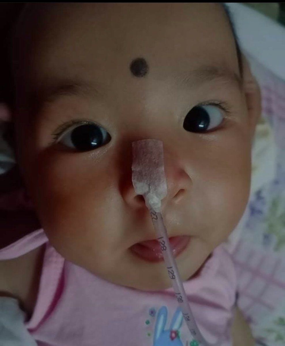 PrithirajGhos20's tweet photo. @SonuSood  @akshaykumar @abhiandniyu 
@imVkohli The baby is suffering from Spinal Muscular Atrophy (SMA) which is a rare disease .His family did their  best to collect money for his treatment but more 1 crore is required for his treatment .
Please donate:https://t.co/UY860qI8V1 https://t.co/rtzHVBac5d