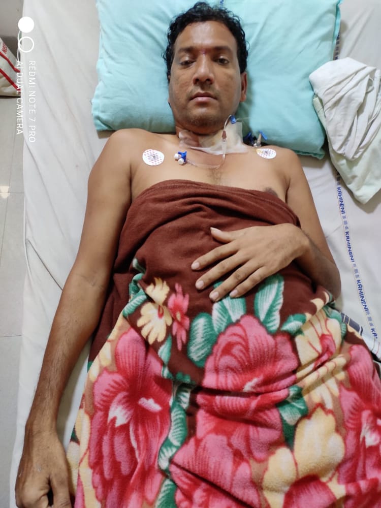 Udaykumarjaddu's tweet photo. @SoodFoundation 
Sir he was my uncle he recently recovered from covid-19 
but later he was effected with black Fungus present he was in Kamineni hospital Vijayawada.
he need "Liposomal Amphotericin B" drug  60 to 80 viles for treatment
He was working as a constructional labour https://t.co/f68EUS6ZG4