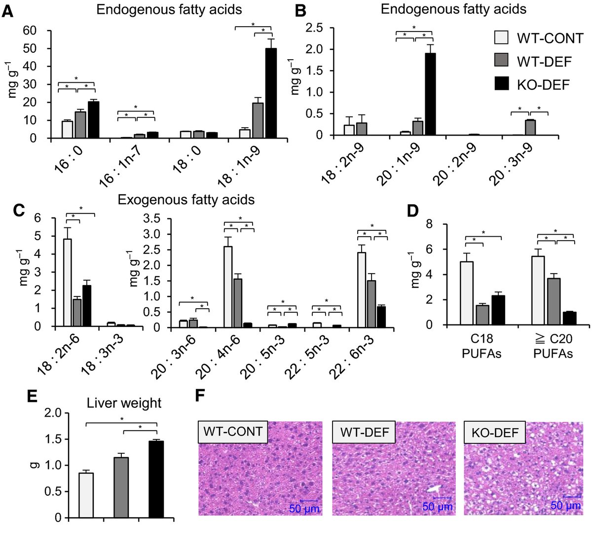 FEBS_Letters's tweet photo. 🐁Ablation of #FADS2 exacerbates #hepatic #triacylglycerol & cholesterol accumulation in #PUFA-depleted mice
➡https://t.co/hcFAJb7iLJ
#metabolism #lipidmetabolism #fattyacid #steatosis #lipogenesis #cholesterolsynthesis #mevalonate #SREBP https://t.co/lmofm3KY2r