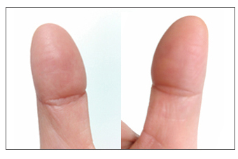 にゅるい ルイ幹雄 Twitter पर おっ すごい 仏目相ってのが小さいけど両親指に１つづつある ある人は強運らしいですよ T Co Vybu79h9uy Twitter