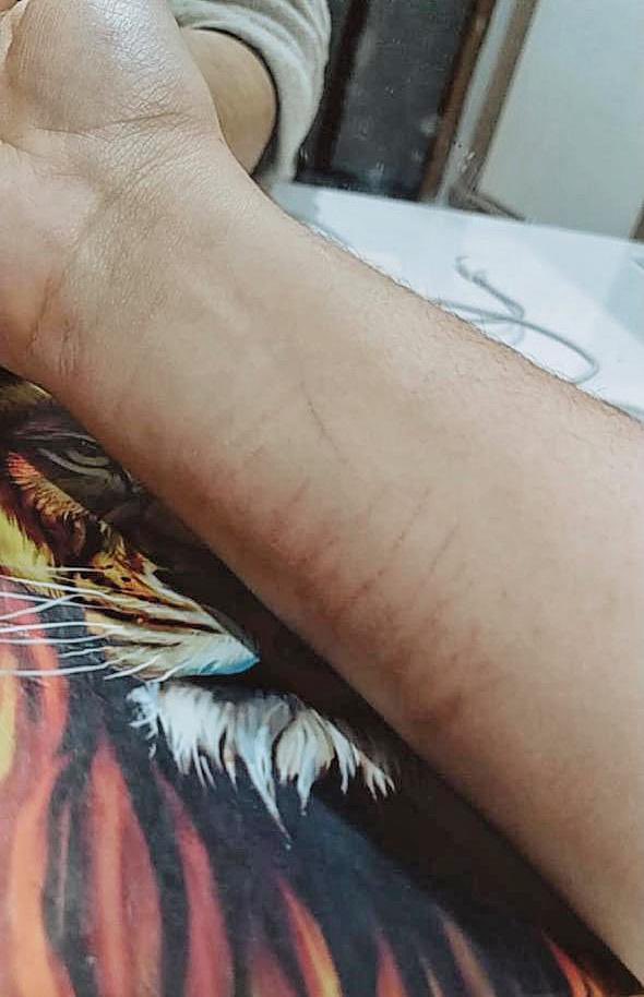 LucaMartinii's tweet photo. a primeira foto é do dia 09/05/21 a segunda do dia 04/06/21! 
SABE O QUE ISSO QUER DIZER? CRISTO VIVE! https://t.co/UsvM0HRaqI
