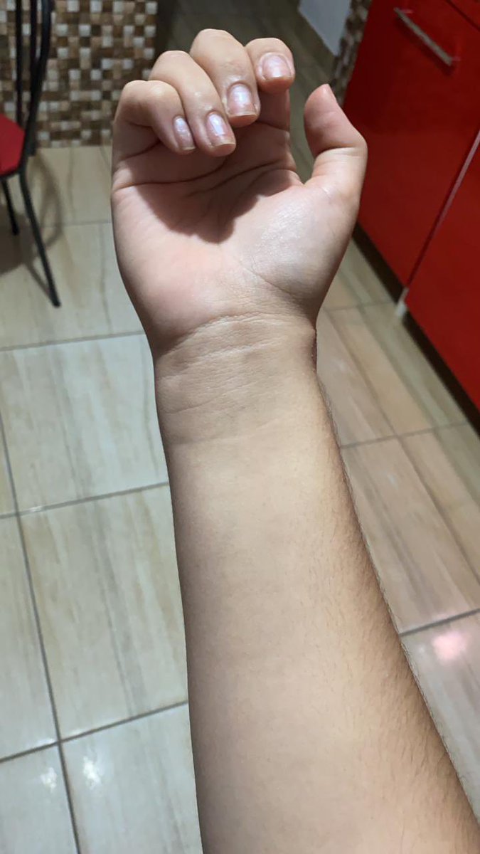LucaMartinii's tweet photo. a primeira foto é do dia 09/05/21 a segunda do dia 04/06/21! 
SABE O QUE ISSO QUER DIZER? CRISTO VIVE! https://t.co/UsvM0HRaqI