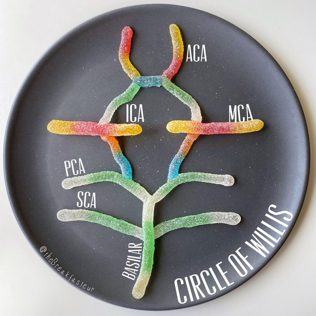 Common locations of bear-y #aneurysms in the circle of Worm-is 🍭 #medtwitter