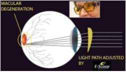 StephensAndDrew's tweet photo. Do you or know anyone who suffers with macular degeneration?
There is a solution out there called e-scoop (https://t.co/yWPjJtV7fY)
Why not call us to discuss
#stephensanddrew #independentopticians #glasses #optical #glassesframes #mgam #myglassesandme #maculardegeneration https://t.co/kOih4EifAU