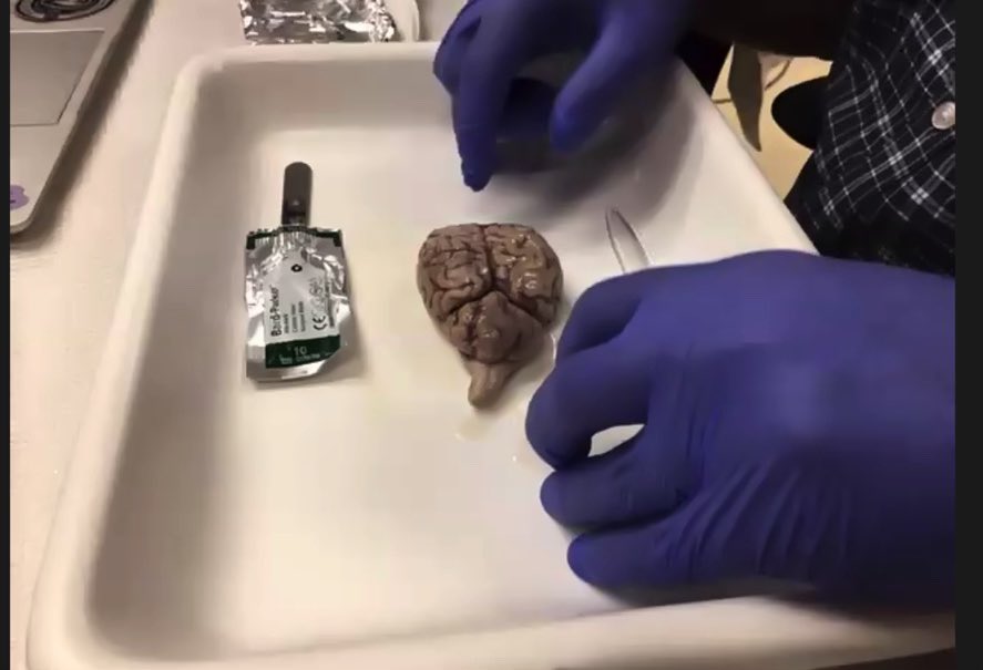 WakePreCollege's tweet photo. You may be wondering how the students can participate in the dissection lab COVID-style… we sent them brains in the mail! 🧠📫 https://t.co/txm1T1NHos