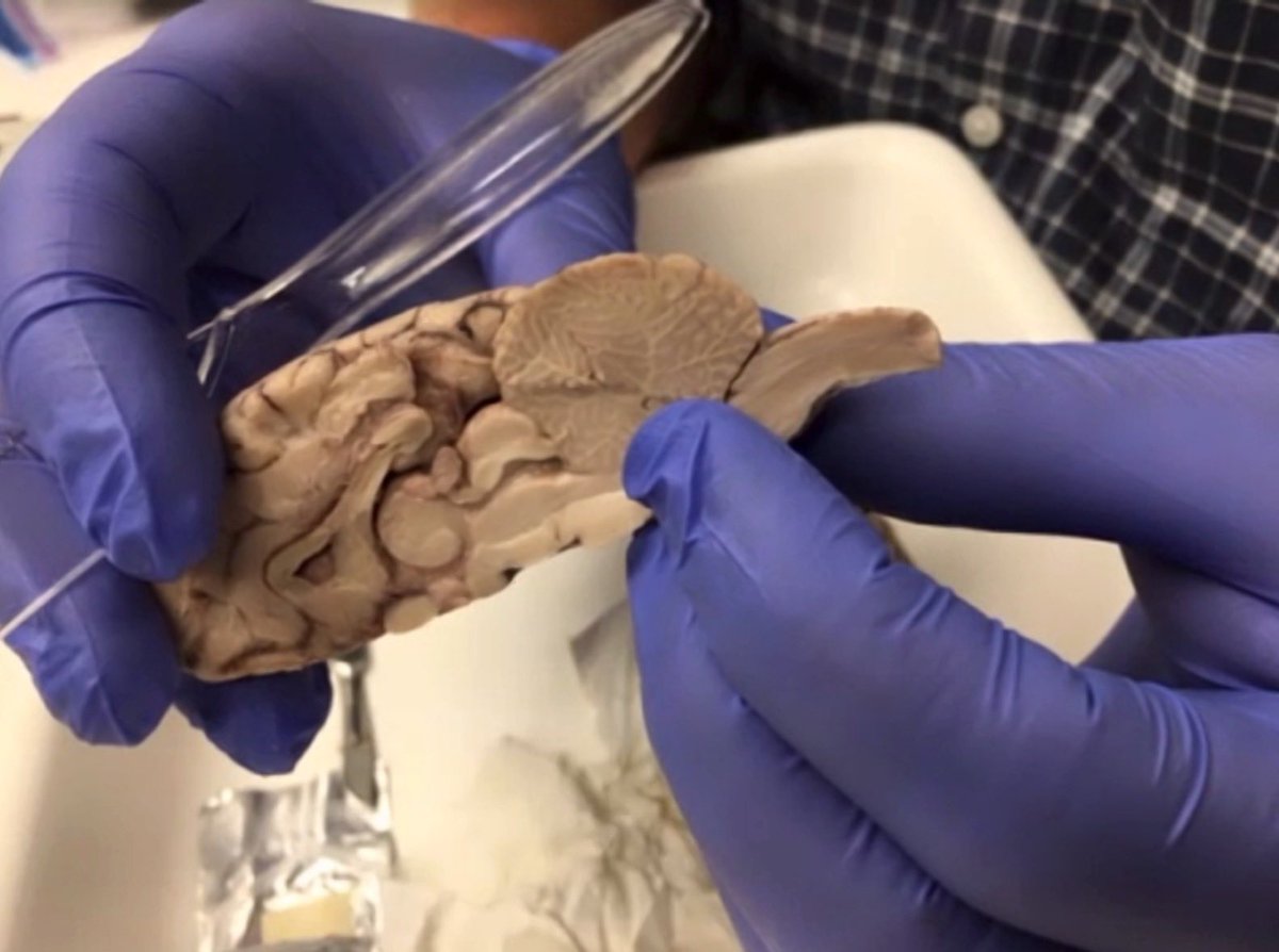 WakePreCollege's tweet photo. 🧠 These future neuroscientists dissected a sheep brain today… swipe for pics!🔥#wfusip #neuroscience https://t.co/gbVYGfBFx7