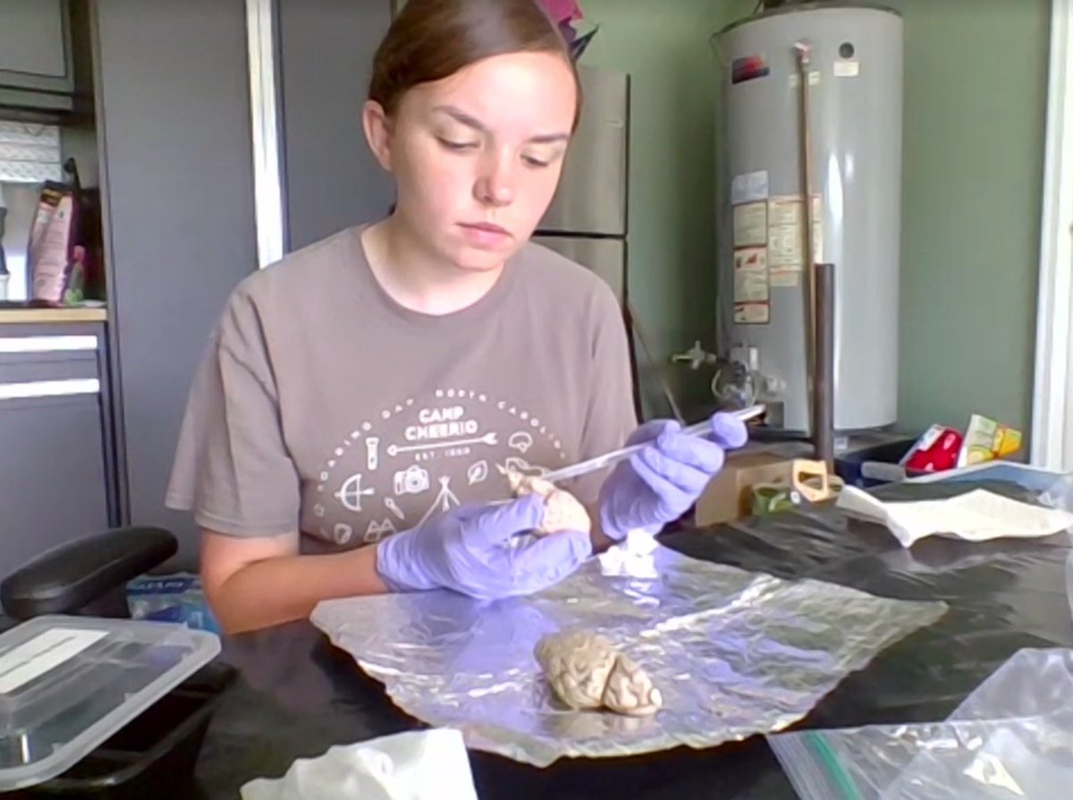 WakePreCollege's tweet photo. 🧠 These future neuroscientists dissected a sheep brain today… swipe for pics!🔥#wfusip #neuroscience https://t.co/gbVYGfBFx7